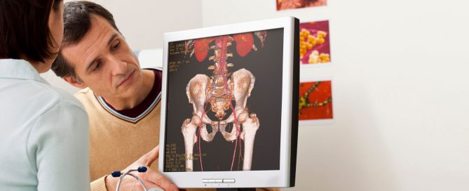 Iliac Vein