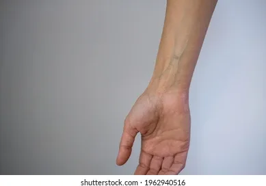 Green Veins