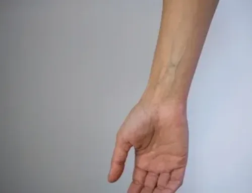 What Causes Green Veins? – 2025