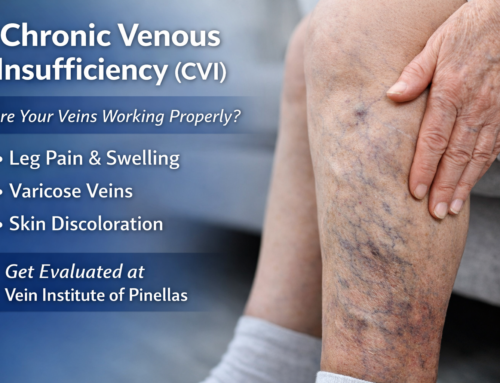 Chronic Venous Insufficiency (CVI): Signs Your Veins Aren’t Working Properly- 2026