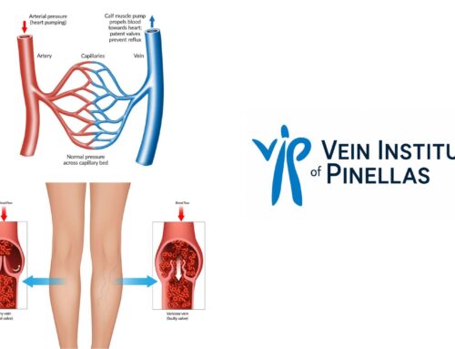 The Benefits of Venoactive Drugs: How They Improve Vein Function and Support Healthy Circulation- 2026