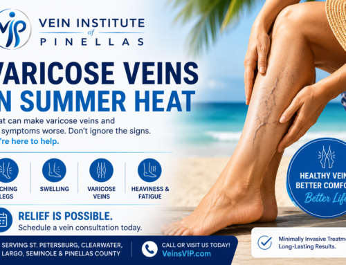 Why Varicose Veins Get Worse in Summer Heat- 2026