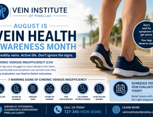 7 Warning Signs of Chronic Venous Insufficiency You Should Not Ignore