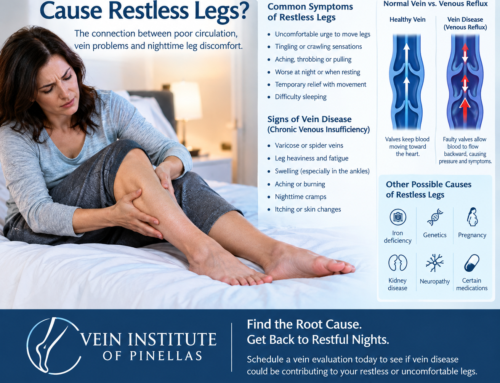 Why Are My Legs Swollen? Signs It May Be a Vein Problem ( Cloned )
